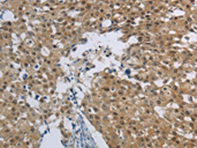 HMGN5 Antibody