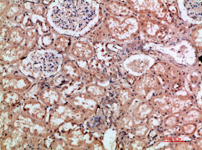 HMMR Antibody