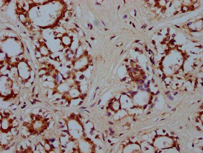 HMX2 Antibody