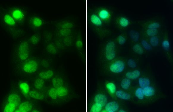 HNF1 alpha antibody