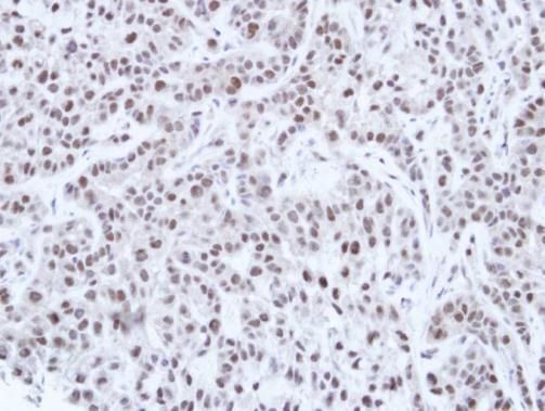 HNF1 alpha Rabbit Polyclonal Antibody