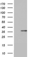 HNF1-Beta(HNF1B) antibody