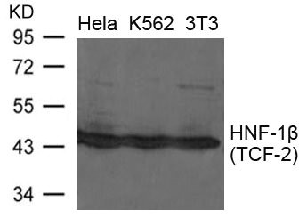 HNF1B antibody