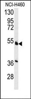 HNF4A antibody