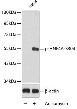 HNF4A (Phospho-S304) antibody