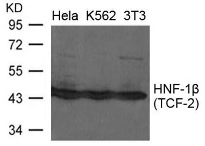 HNFβ(TCF-2) Antibody