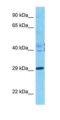 HNRDL antibody