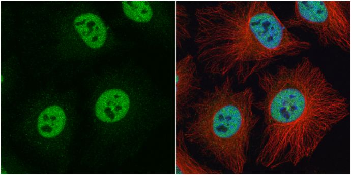 heterogeneous nuclear ribonucleoprotein C (C1/C2) Antibody