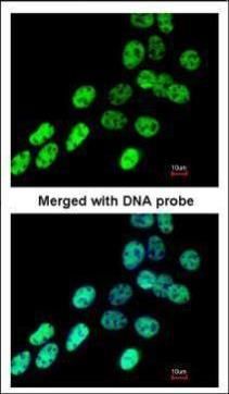 hnRNP F antibody