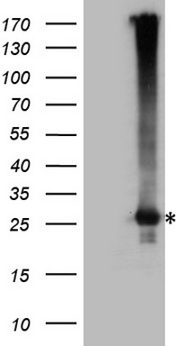 hnRNP L (HNRNPL) antibody