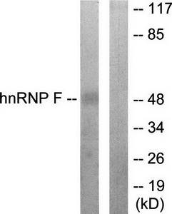 hnRNP F Antibody