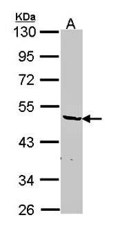 hnRNP F antibody