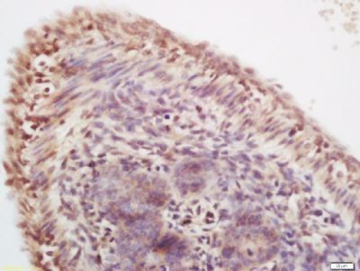 HnRNP R Rabbit Polyclonal Antibody