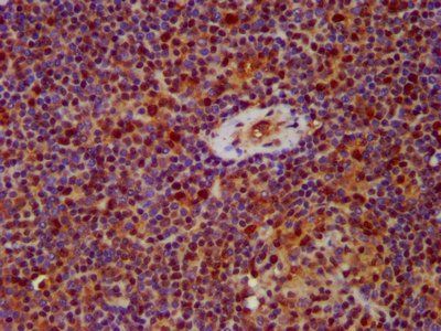 HNRNPAB Antibody