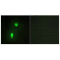 HNRNPC Antibody