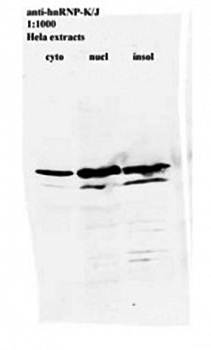 hnRNP K Monoclonal antibody [3C2] - 0.1ml