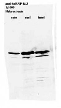 hnRNP K Monoclonal antibody [3C2] - 50ul