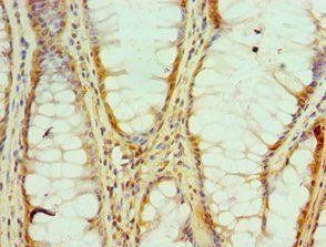 HNRNPM Antibody