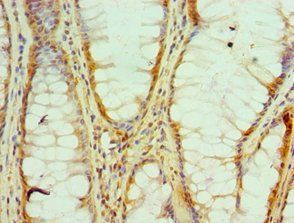 HNRNPM antibody