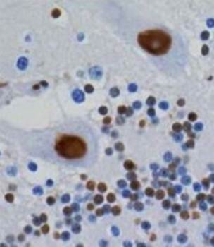 hnRNP U/p120 Monoclonal Antibody [3G6] - 50ul