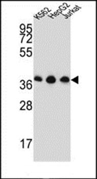 HNRPDL antibody