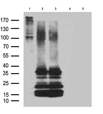 HNRPH1 (HNRNPH1) antibody