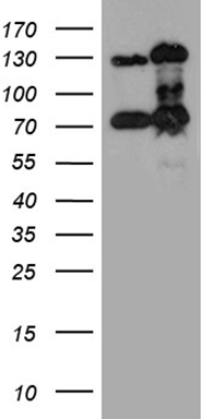 Homeo box C10 (HOXC10) antibody