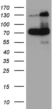 Homeo box C10 (HOXC10) antibody