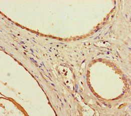 Homeobox protein OTX2 antibody