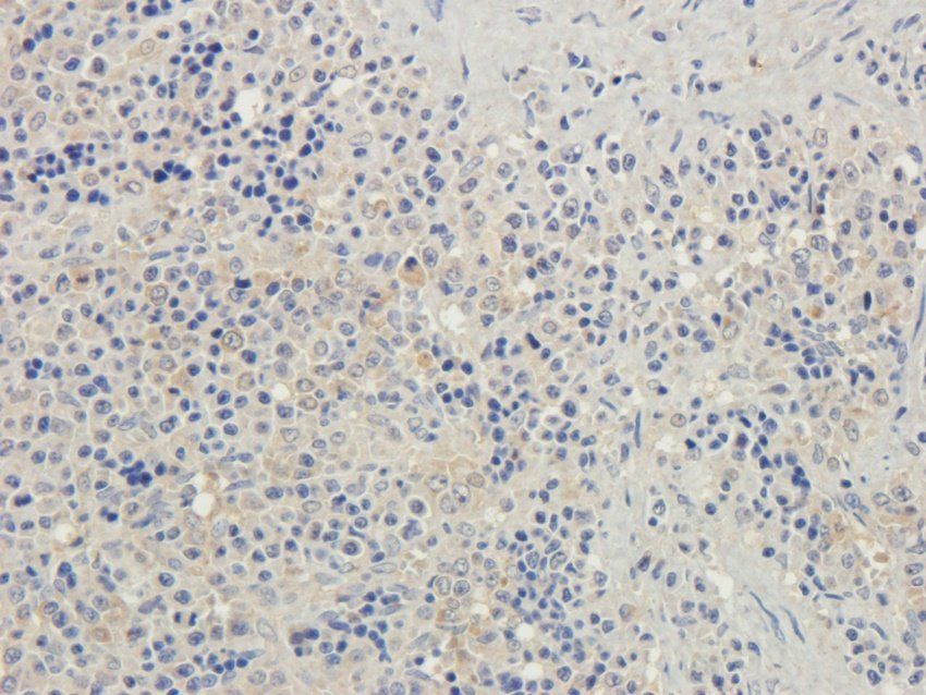 HOMER1 Rabbit Polyclonal Antibody