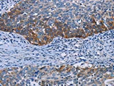 HOMER1 Antibody