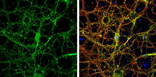 homer scaffold protein 1 Antibody