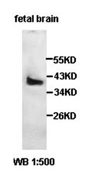 HOMER1 Rabbit Polyclonal Antibody