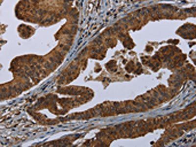 HOMER2 Antibody