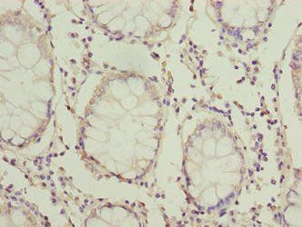 HOOK1 Antibody