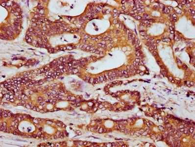 HOOK3 Antibody