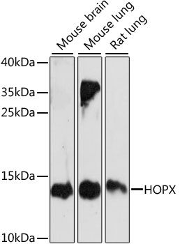 HOPX antibody