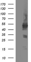 Host cell factor C2 (HCFC2) antibody