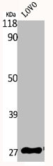 HOXA11 antibody