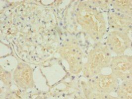 HOXA6 Antibody