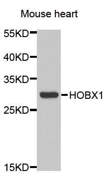 HOXB1 antibody