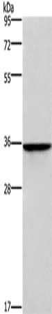 HOXB2 antibody