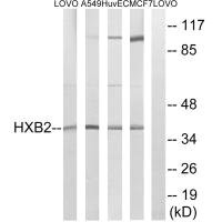 HOXB2 antibody