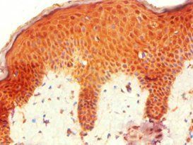 HOXB7 Antibody