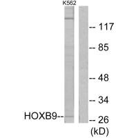 HOXB9 antibody