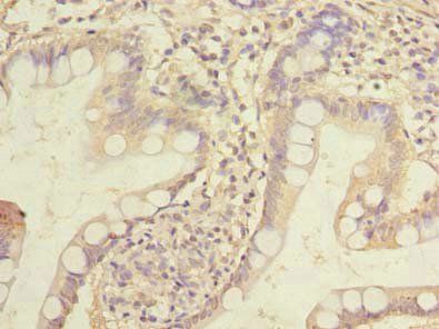 HOXC11 Antibody
