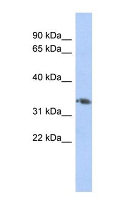 HOXD10 antibody