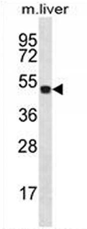HOXD10 antibody
