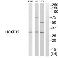 HOXD12 antibody