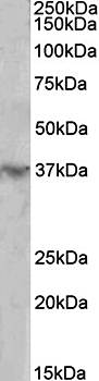 HOXD12 antibody